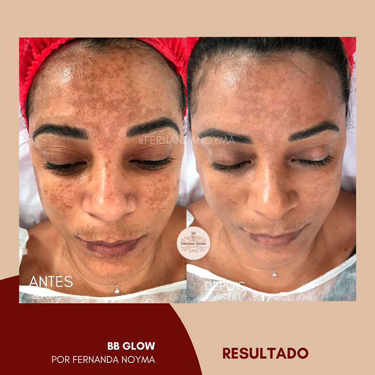 Curso de BBGLow Online